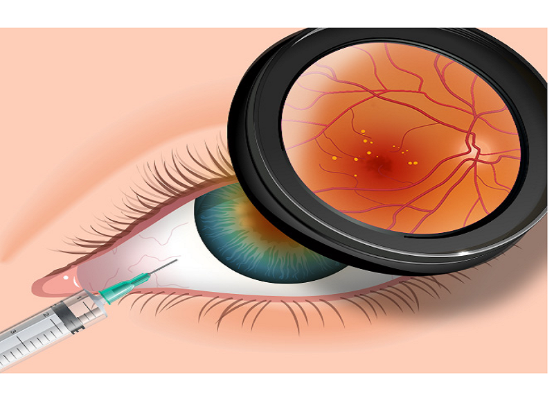  Ophthalmic Suites