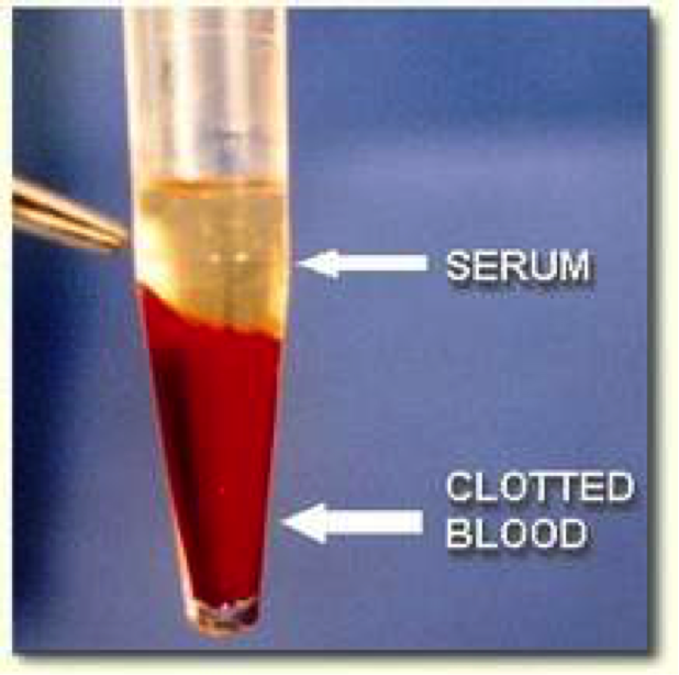 Your Blood-Your Tears - Ophthalmic Suites